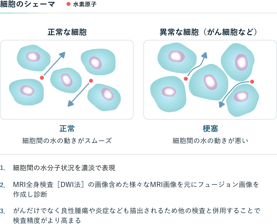 細胞のシェーマ 正常な細胞：正常、細胞間の水の動きがスムーズ。異常な細胞（がん細胞など）：梗塞、細胞間の水の動きが悪い。 1.細胞間の水分子状況を濃淡で表現 2.MRI全身検査［DWI法］の画像含めた様々なMRI画像を元にフュージョン画像を作成し診断 3.がんだけでなく良性腫瘍や炎症なども描出されるため他の検査と併用することで検査精度がより高まる